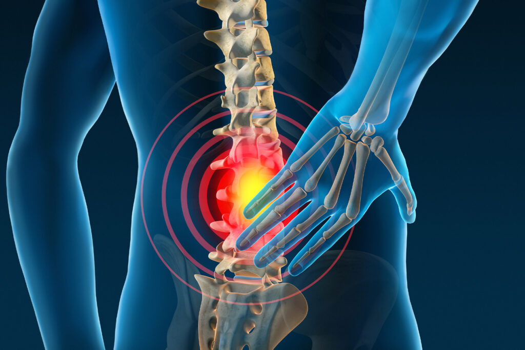 6 Methods to Enhance Your Again Ache